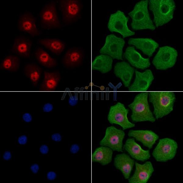 Phospho-YY1 (Ser365) Antibody - AF3694 staining Hela cells(heat shock treatment) by IF/ICC.