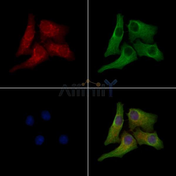 Phospho-Rab3A (Thr86) Antibody - AF3707 staining Hela cells(heat shock treatment) by IF/ICC.