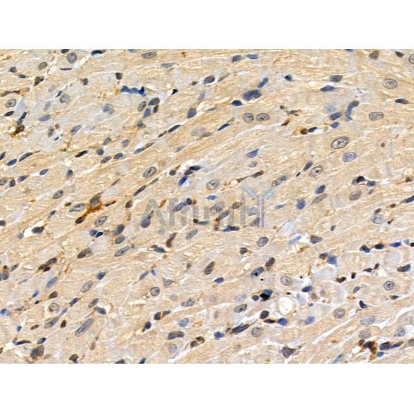 Phospho-MKK3/MKK6 (Ser189/Thr193) Antibody - AF3805 at 1/100 staining Rat heart tissue by IHC-P.