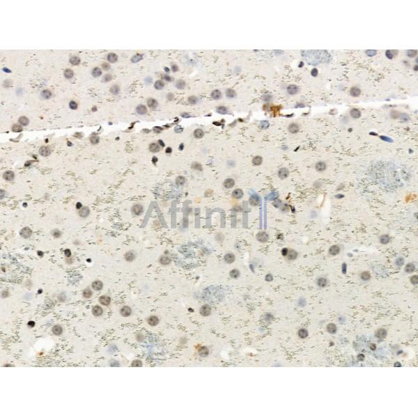 Phospho-RSK1 p90 (Thr348) Antibody - AF3811 at 1/100 staining Mouse brain tissue by IHC-P.