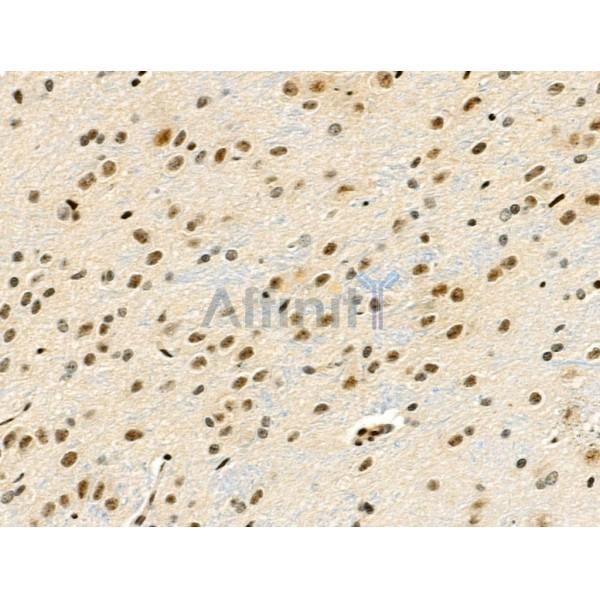 Phospho-RSK1 p90 (Thr348) Antibody - AF3811 at 1/100 staining Rat brain tissue by IHC-P.