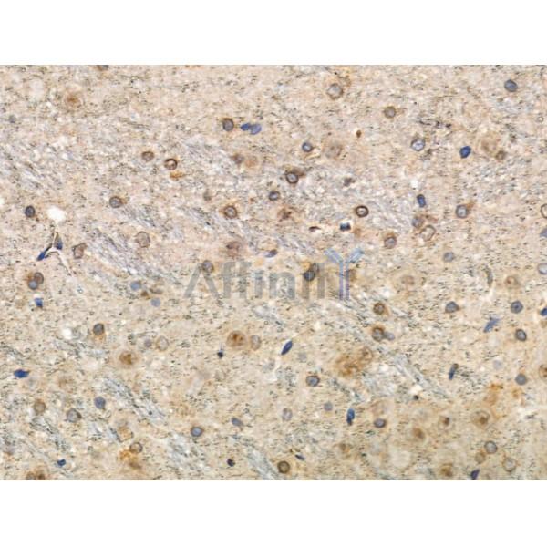 Phospho-Tau (Thr492/Thr175) Antibody - AF3825 at 1/100 staining Rat brain tissue by IHC-P.