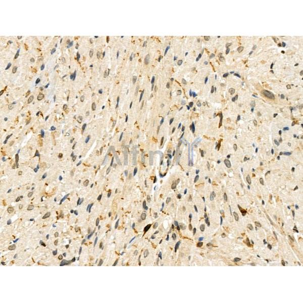 Phospho-ZEB2 (Ser784) Antibody - AF3840 at 1/100 staining Rat heart tissue by IHC-P.