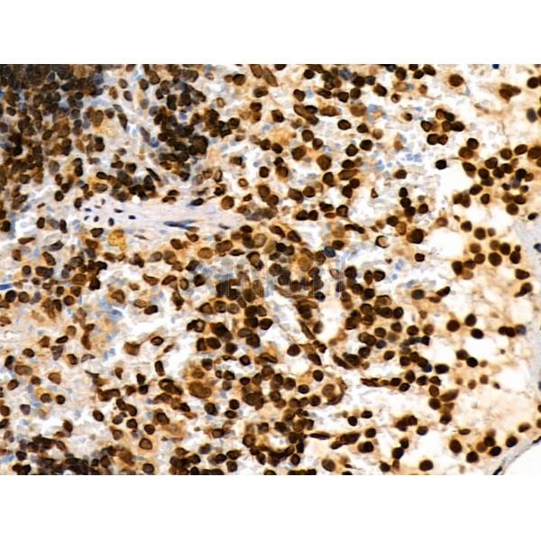 Phospho-AIRE (Ser156) Antibody - AF3841 at 1/100 staining Rat spleen tissue by IHC-P.