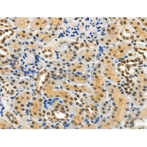 Phospho-AIRE (Ser156) Antibody - AF3841 at 1/100 staining Rat kidney tissue by IHC-P.