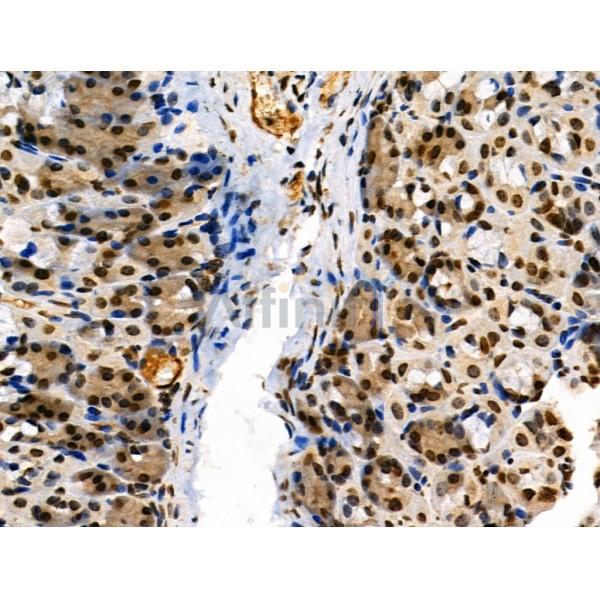 Phospho-AIRE (Ser156) Antibody - AF3841 at 1/100 staining Mouse stomach tissue by IHC-P.