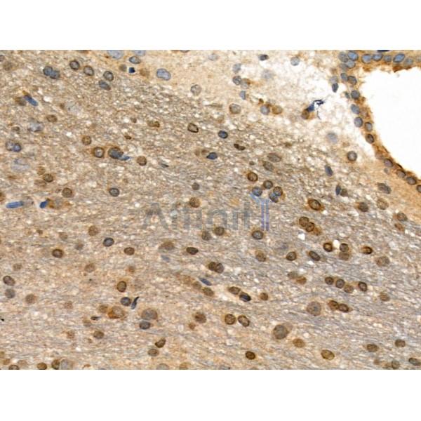 Phospho-AIRE (Ser156) Antibody - AF3841 at 1/100 staining Rat brain tissue by IHC-P.
