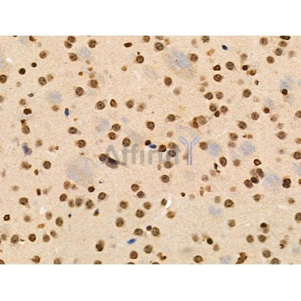 Phospho-AIRE (Ser156) Antibody - AF3841 at 1/100 staining Mouse brain tissue by IHC-P.