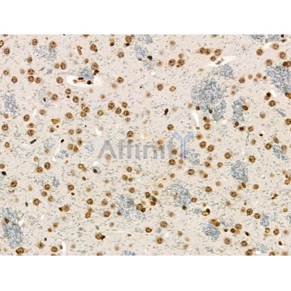 Phospho-MKK4 (Ser257/Thr261) Antibody - AF3862 at 1/100 staining Mouse brain tissue by IHC-P.