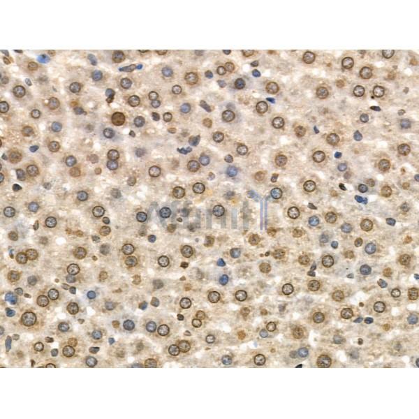Phospho-MCM2 (Ser108) Antibody - AF3877 at 1/100 staining Rat liver tissue by IHC-P.