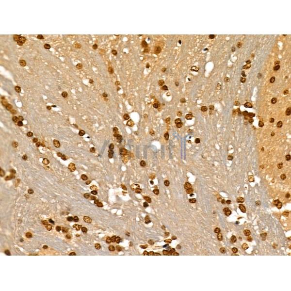 Phospho-MCM2 (Ser108) Antibody - AF3877 at 1/100 staining Mouse brain tissue by IHC-P.