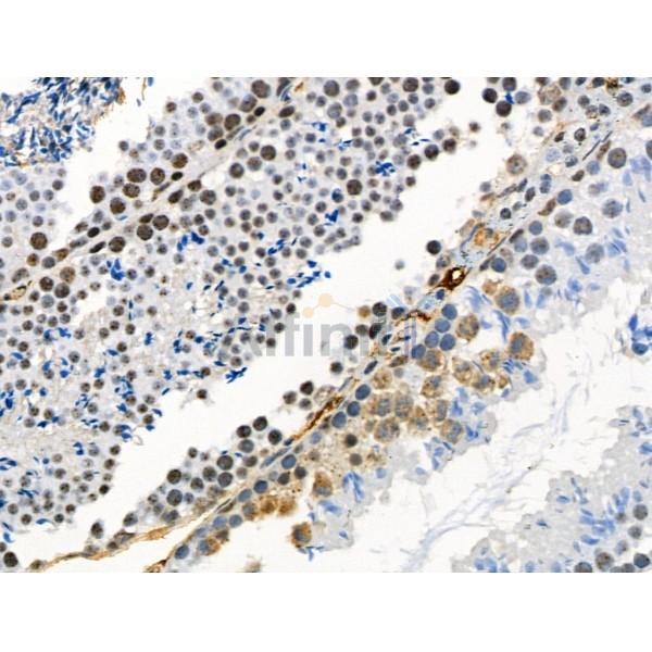 Phospho-Catenin 1 (Ser320) Antibody - AF4384 at 1/100 staining Mouse testis tissue by IHC-P.