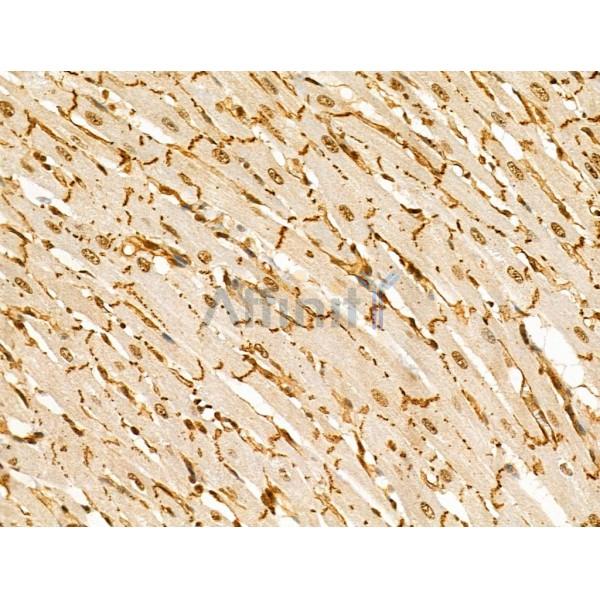 Phospho-Desmoplakin (Ser165/Ser166) Antibody - AF4409 at 1/100 staining Rat heart tissue by IHC-P.