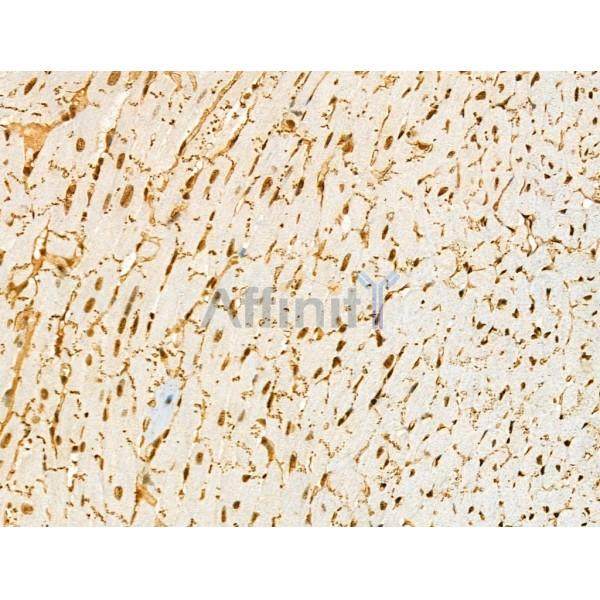 Phospho-Desmoplakin (Ser165/Ser166) Antibody - AF4409 at 1/100 staining Mouse heart tissue by IHC-P.
