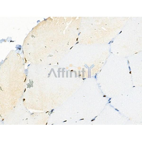 Phospho-PAR4 (Thr163) Antibody - AF4485 at 1/100 staining Rat muscle tissue by IHC-P.