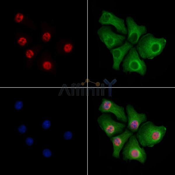 SIRT6 Antibody - AF6570 staining Hela cells by IF/ICC.