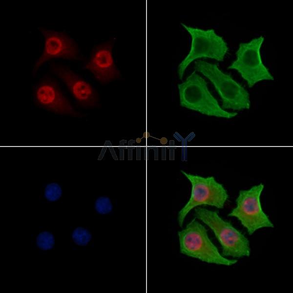 YY1 Antibody - AF6694 staining Hela cells by IF/ICC.