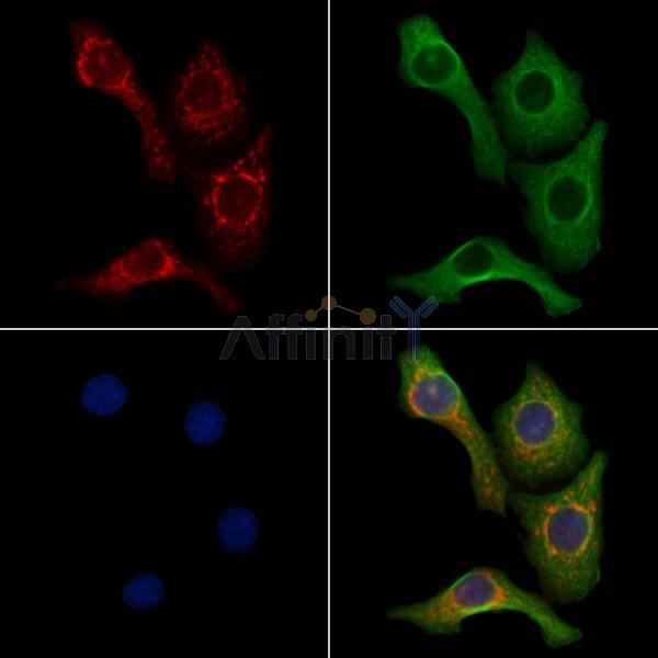 Rab3A Antibody - AF6707 staining Hela cells by IF/ICC.