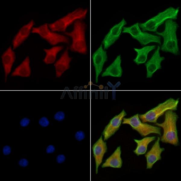 GAP43 Antibody - AF6715 staining Hela cells by IF/ICC.