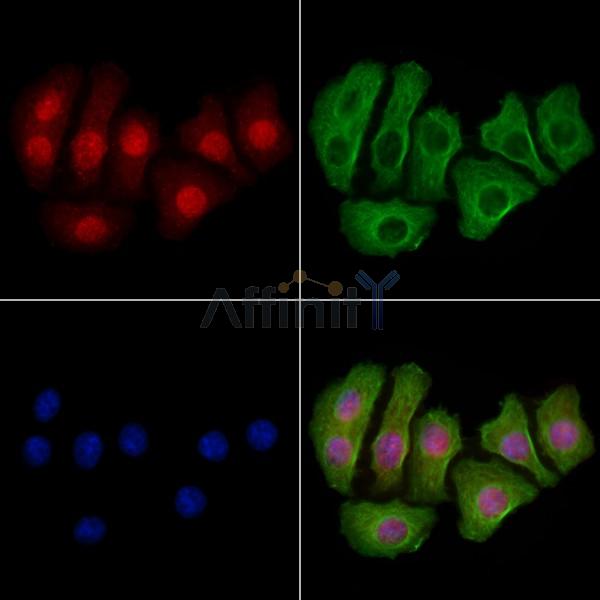 Progesterone Receptor Antibody - AF6742 staining Hela cells by IF/ICC.