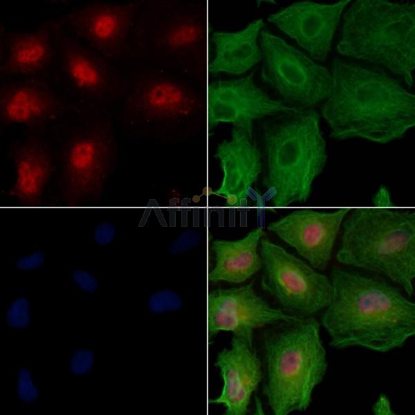 Bub1 Antibody - AF6768 staining A549 cells by IF/ICC.