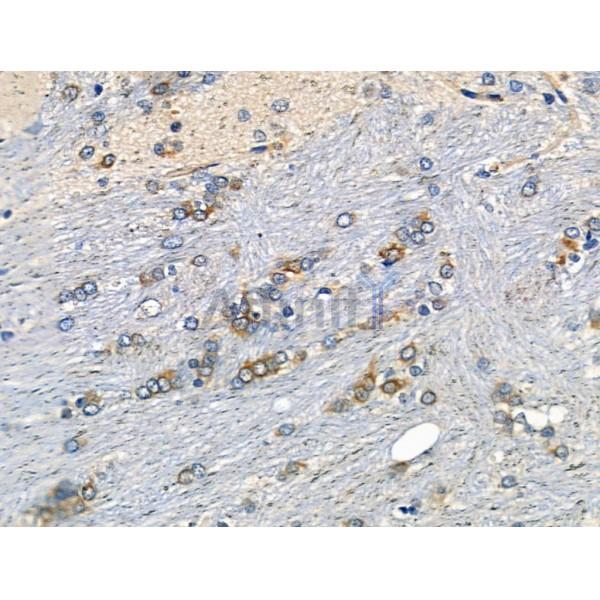 Phospho-NFAT2 (Ser294) Antibody - AF8012 at 1/100 staining Rat brain tissue by IHC-P.