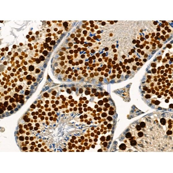 Phospho-TLK1 (Ser741) Antibody - AF8029 at 1/100 staining Mouse testis tissue by IHC-P.