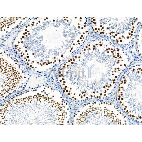 Phospho-TLK1 (Ser741) Antibody - AF8029 at 1/100 staining Rat testis tissue by IHC-P.