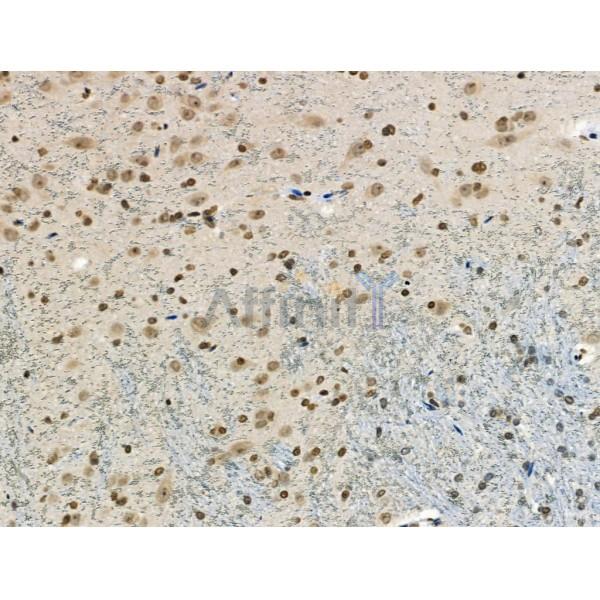 Phospho-CAMKK1/2 (Ser458/Ser495) Antibody - AF8136 at 1/100 staining Rat brain tissue by IHC-P.