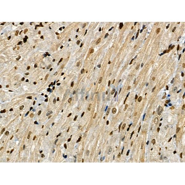 Phospho-CAMKK1/2 (Ser458/Ser495) Antibody - AF8136 at 1/100 staining Rat heart tissue by IHC-P.