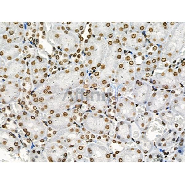 Phospho-CAMKK1/2 (Ser458/Ser495) Antibody - AF8136 at 1/100 staining Rat kidney tissue by IHC-P.