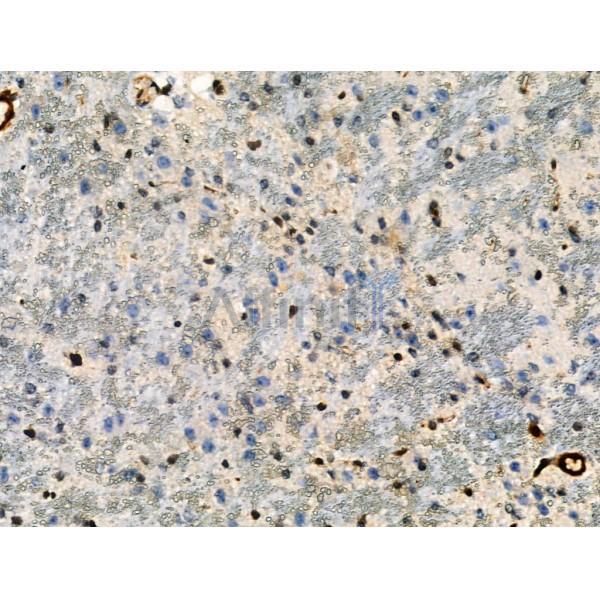 Phospho-RXR alpha (Ser260) Antibody - AF8214 at 1/100 staining Mouse brain tissue by IHC-P.