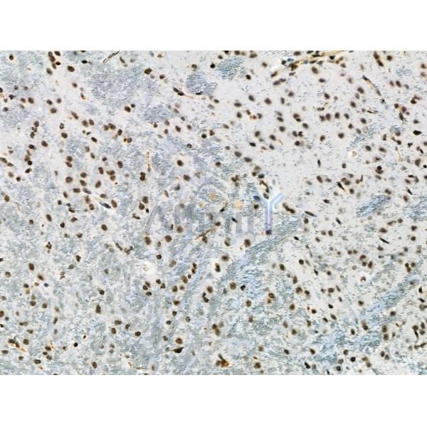 Phospho-p53 (Ser392) Antibody - AF8295 at 1/100 staining Mouse brain tissue by IHC-P.