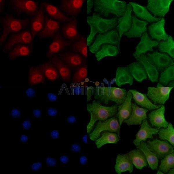 Phospho-Smad4 (Thr276)[Thr277] Antibody - AF8316 staining Hela cells(heat shock treatment) by IF/ICC.