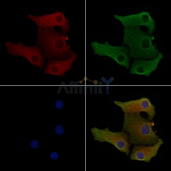 FCGR2B/CD32B Antibody - AF9038 staining Hela cells by IF/ICC.
