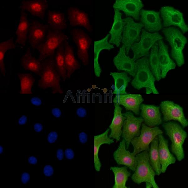 NIPA Antibody - AF9132 staining Hela cells by IF/ICC.
