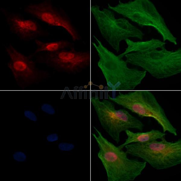 GFI1B Antibody - DF10049 staining A549 cells by IF/ICC.
