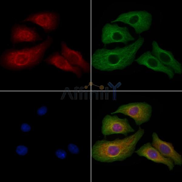 Myelin PLP Antibody - DF13282 staining Hela cells by IF/ICC.