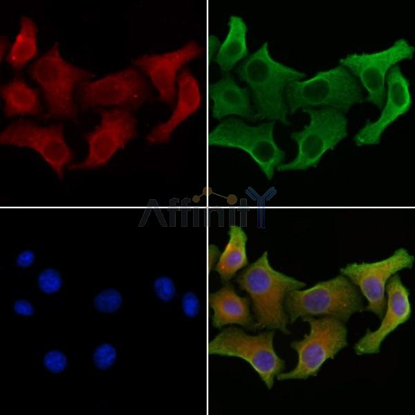 Glypican 2 Antibody - DF13374 staining Hela cells by IF/ICC.