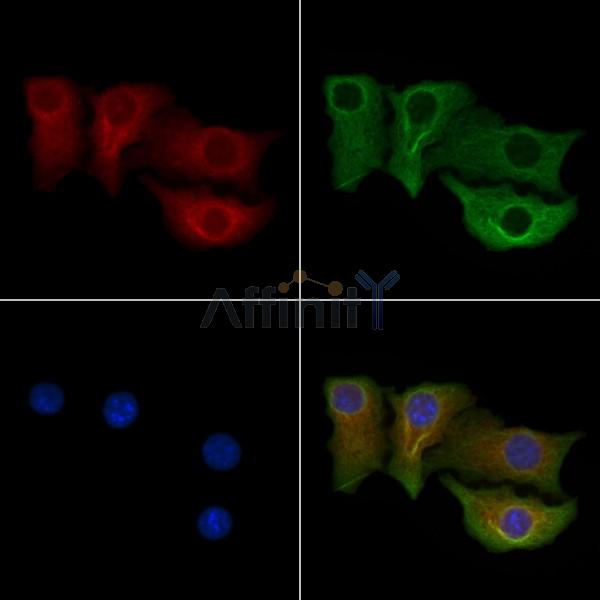CPEB4 Antibody - DF13495 staining Hela cells by IF/ICC.