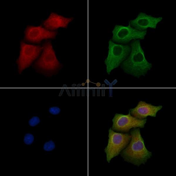 ART4 Antibody - DF13496 staining Hela cells by IF/ICC.