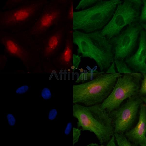 CCNT2 Antibody - DF2289 staining A549 cells by IF/ICC.