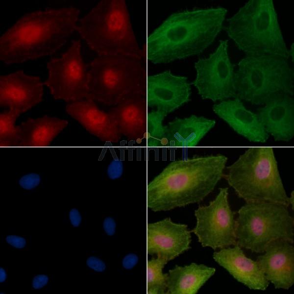 CENPT Antibody - DF2319 staining A549 cells by IF/ICC.