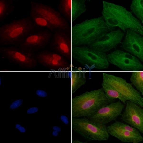 ZSCAN2 Antibody - DF2422 staining A549 cells by IF/ICC.