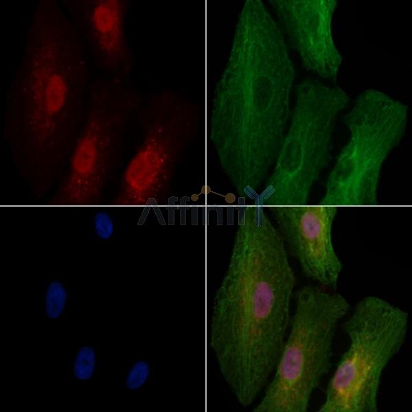 CPEB1 Antibody - DF2462 staining A549 cells by IF/ICC.