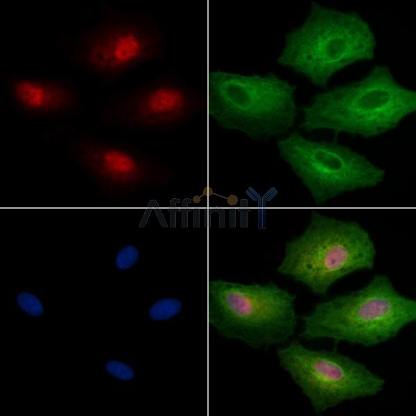 EHMT1 Antibody - DF2491 staining A549 cells by IF/ICC.