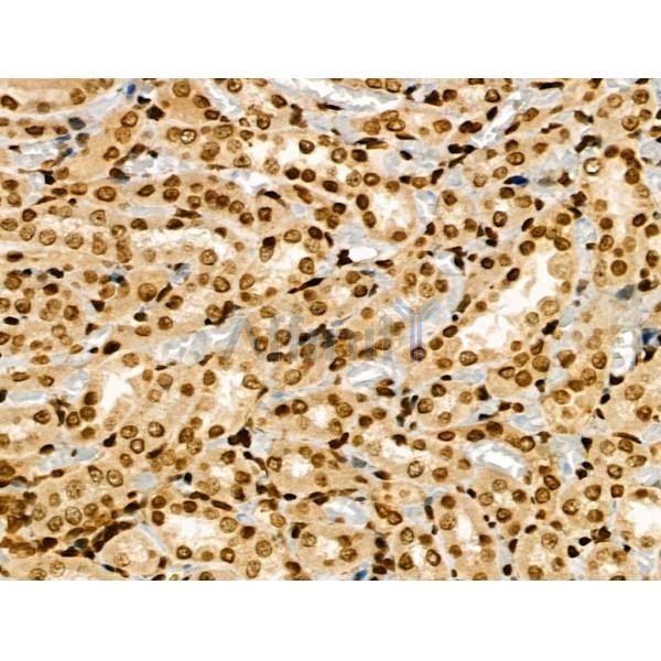 MYST2 Antibody - DF3056 at 1/100 staining Rat kidney tissue by IHC-P.