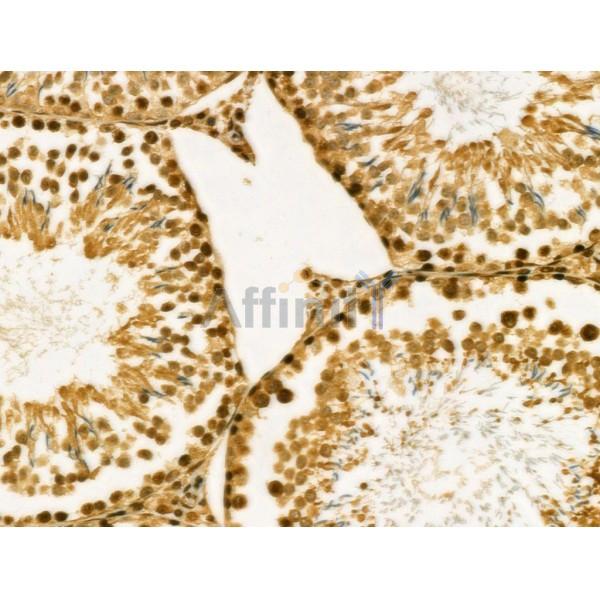 MYST2 Antibody - DF3056 at 1/100 staining Rat testis tissue by IHC-P.