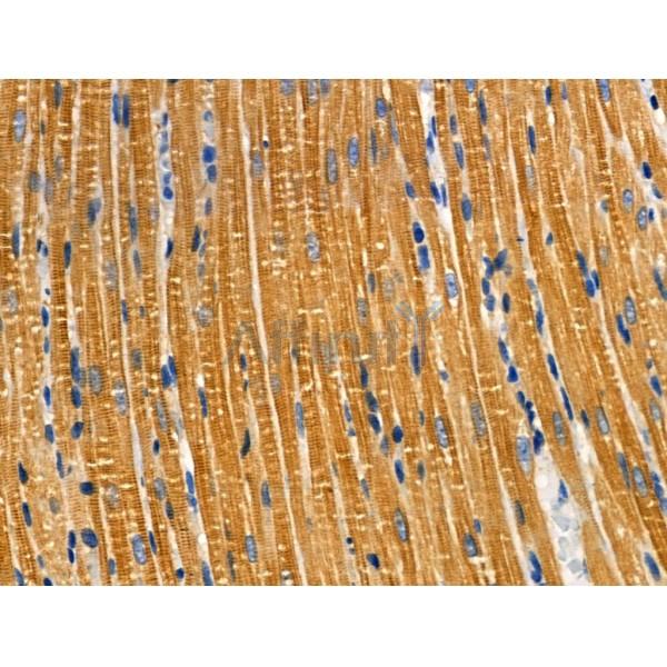 TACD2 Antibody - DF3080 at 1/100 staining Rat heart tissue by IHC-P.