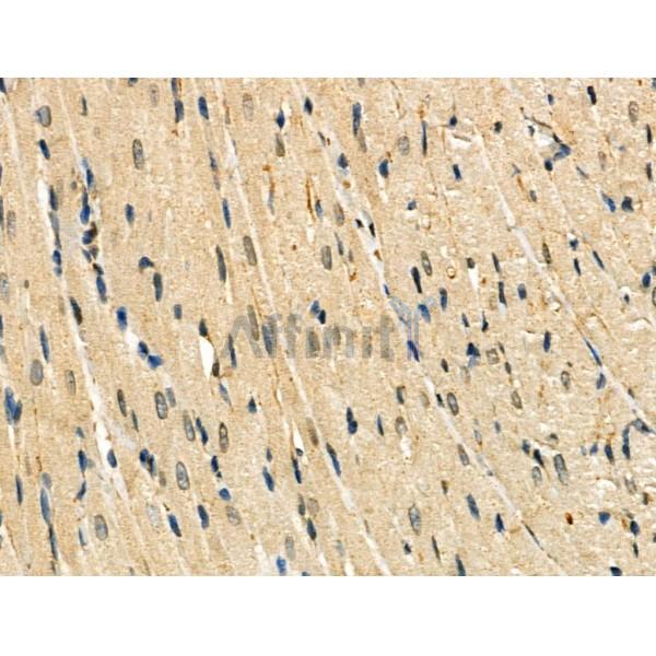 NR2F6 Antibody - DF3085 at 1/100 staining Rat heart tissue by IHC-P.